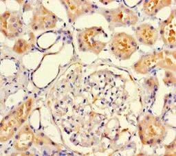 Immunohistochemistry of paraffin-embedded human kidney tissue using CSB-PA800218LA01HU at dilution of 1:100
