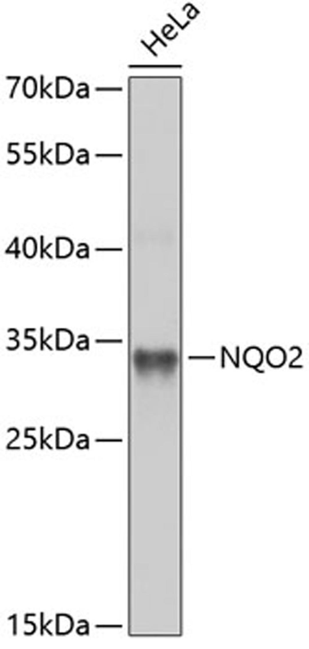 Western blot - NQO2 antibody (A5440)