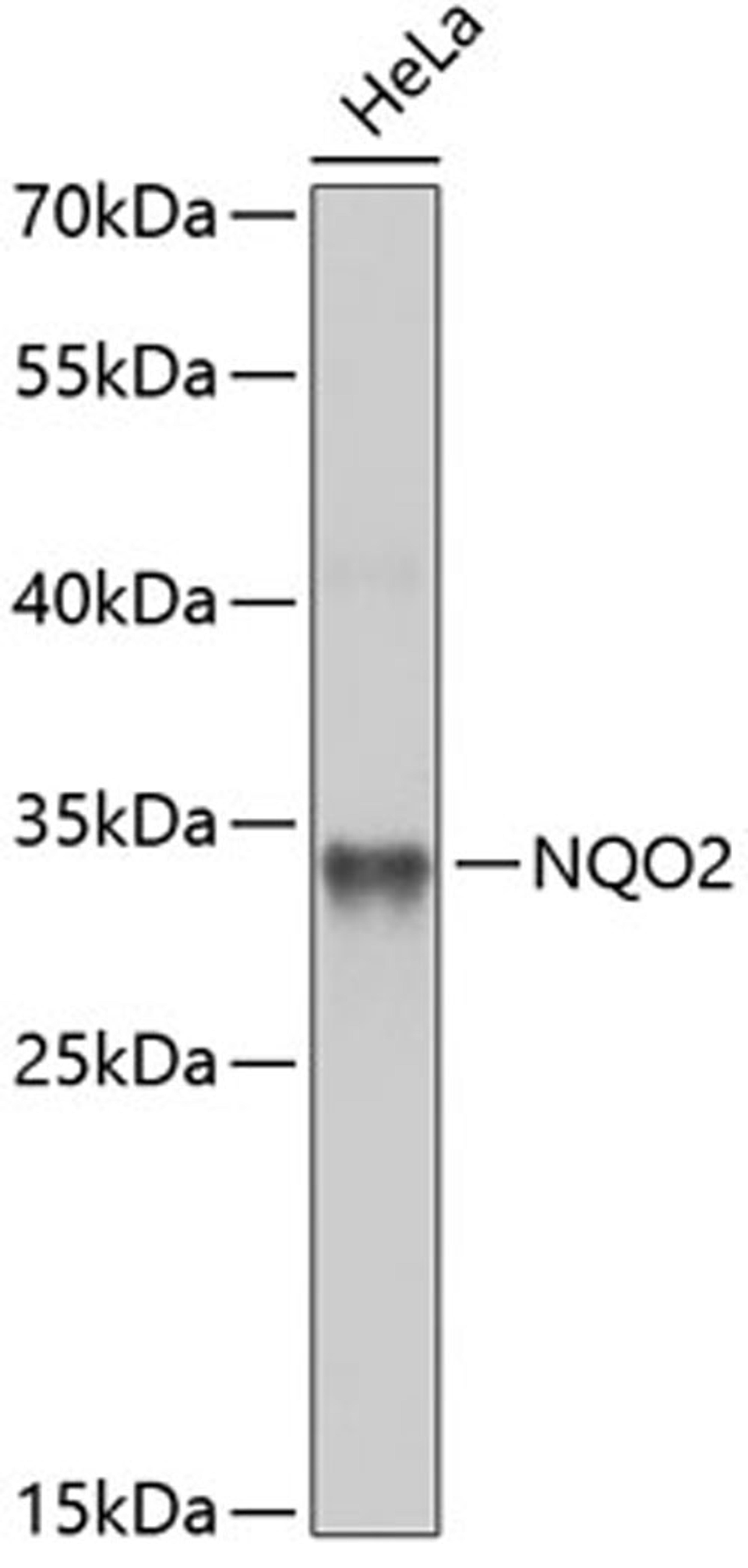 Western blot - NQO2 antibody (A5440)