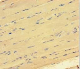 Immunohistochemistry of paraffin-embedded human skeletal muscle tissue using CSB-PA883616HA01HU at dilution of 1:100