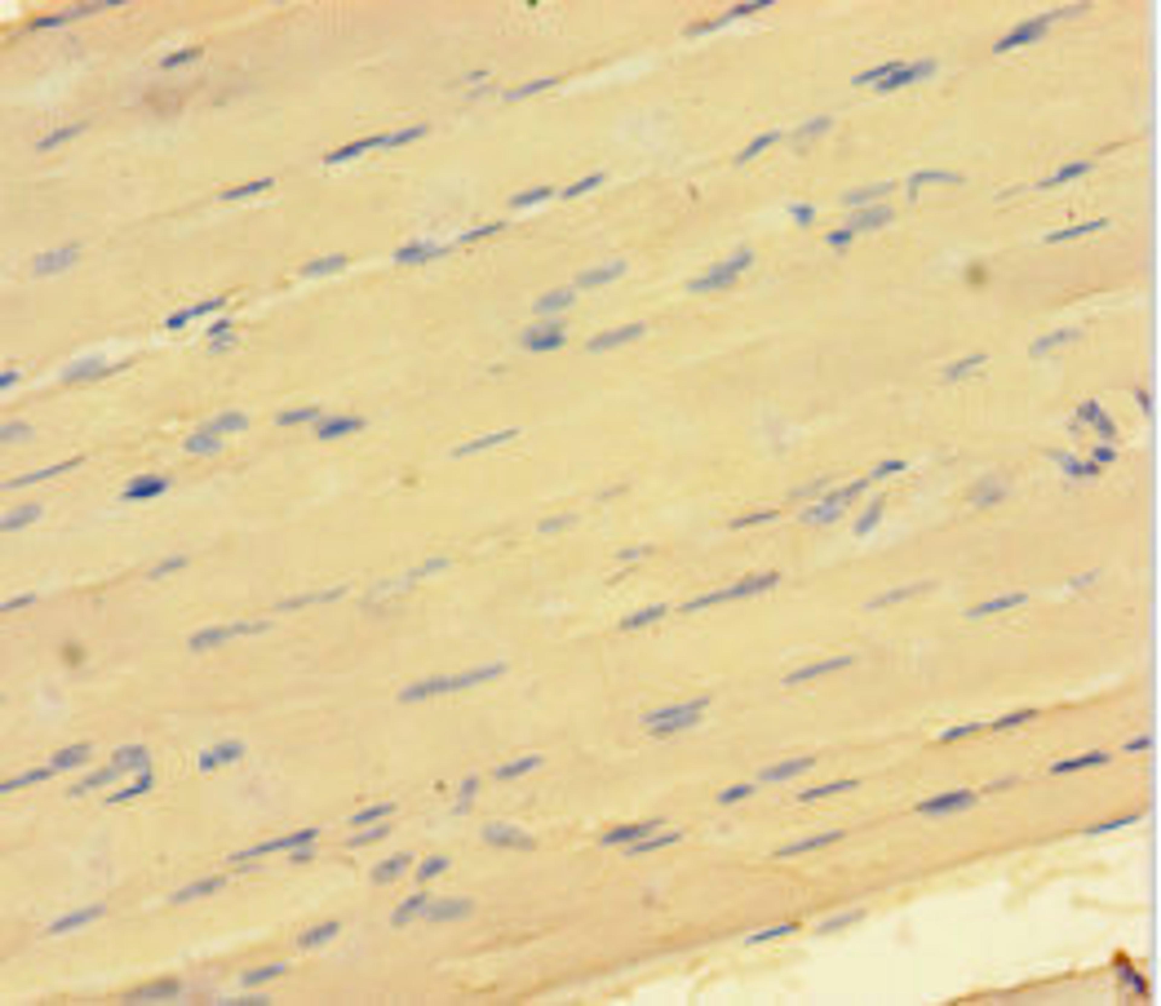 Immunohistochemistry of paraffin-embedded human skeletal muscle tissue using CSB-PA883616HA01HU at dilution of 1:100