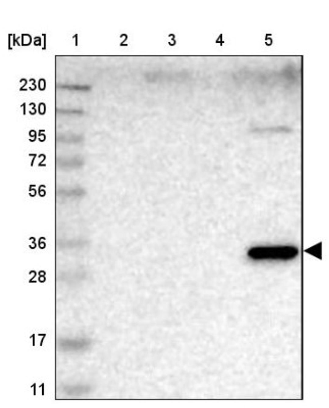 Western Blot: HS3ST2 Antibody [NBP1-89374] - Lane 1: Marker [kDa] 230, 130, 95, 72, 56, 36, 28, 17, 11<br/>Lane 2: Human cell line RT-4<br/>Lane 3: Human cell line U-251MG sp<br/>Lane 4: Human plasma (IgG/HSA depleted)<br/>Lane 5: Human liver tissue