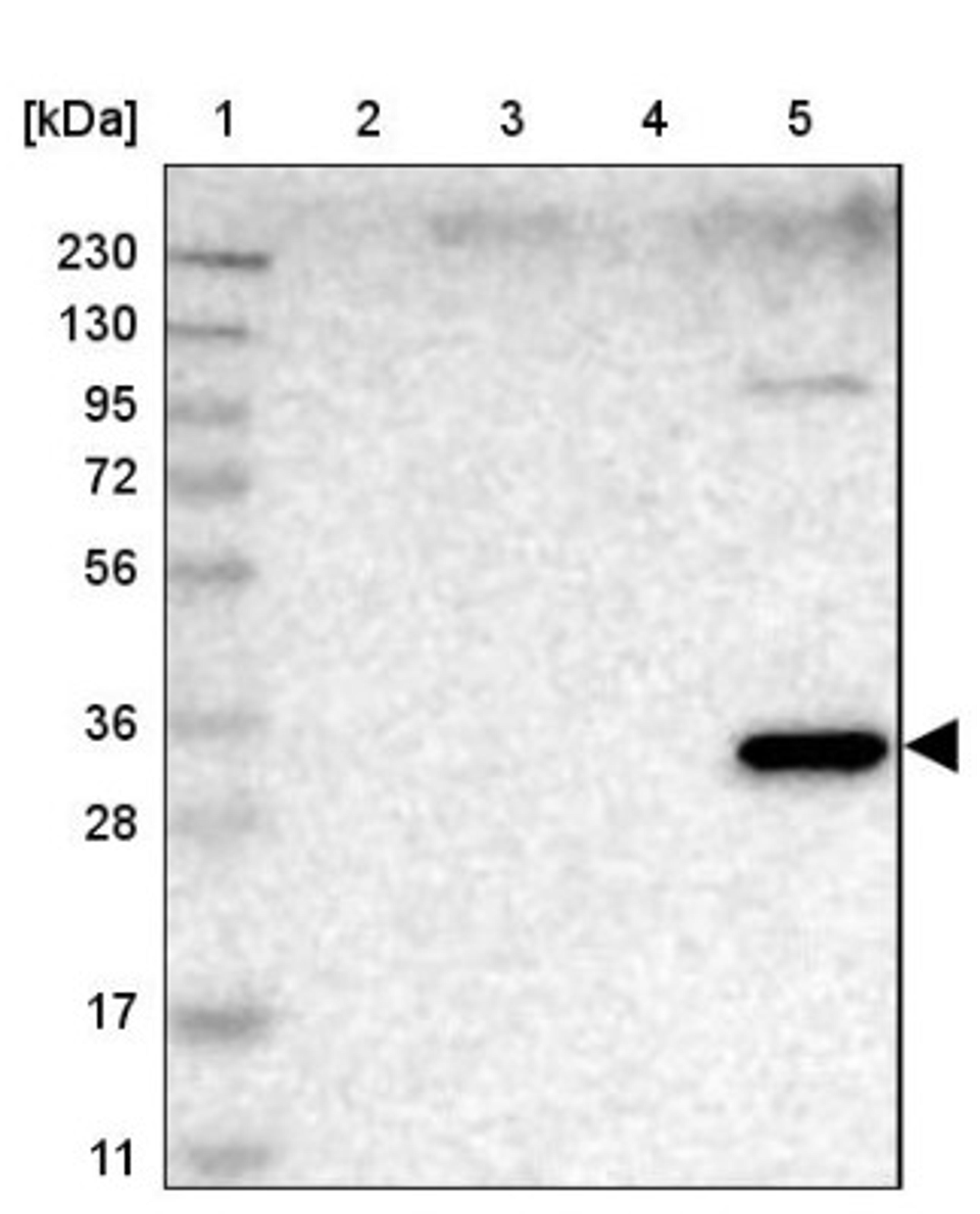 Western Blot: HS3ST2 Antibody [NBP1-89374] - Lane 1: Marker [kDa] 230, 130, 95, 72, 56, 36, 28, 17, 11<br/>Lane 2: Human cell line RT-4<br/>Lane 3: Human cell line U-251MG sp<br/>Lane 4: Human plasma (IgG/HSA depleted)<br/>Lane 5: Human liver tissue