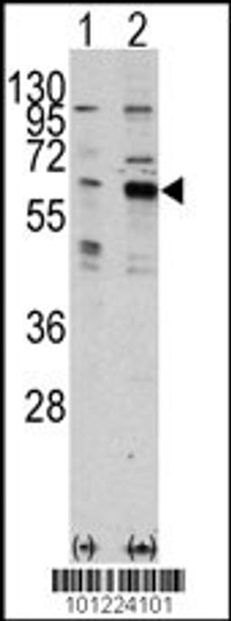 Western blot analysis of PAK3 using rabbit polyclonal PAK3 Antibody using 293 cell lysates (2 ug/lane) either nontransfected (Lane 1) or transiently transfected with the PAK3 gene (Lane 2).