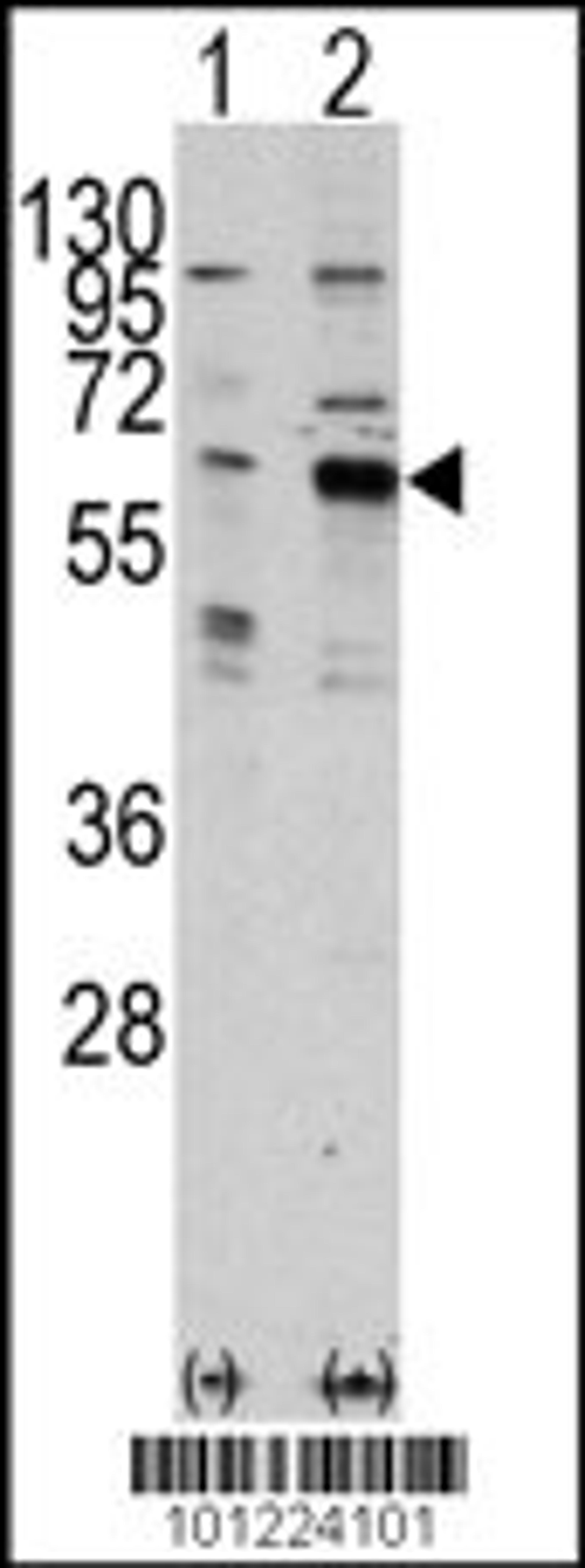 Western blot analysis of PAK3 using rabbit polyclonal PAK3 Antibody using 293 cell lysates (2 ug/lane) either nontransfected (Lane 1) or transiently transfected with the PAK3 gene (Lane 2).