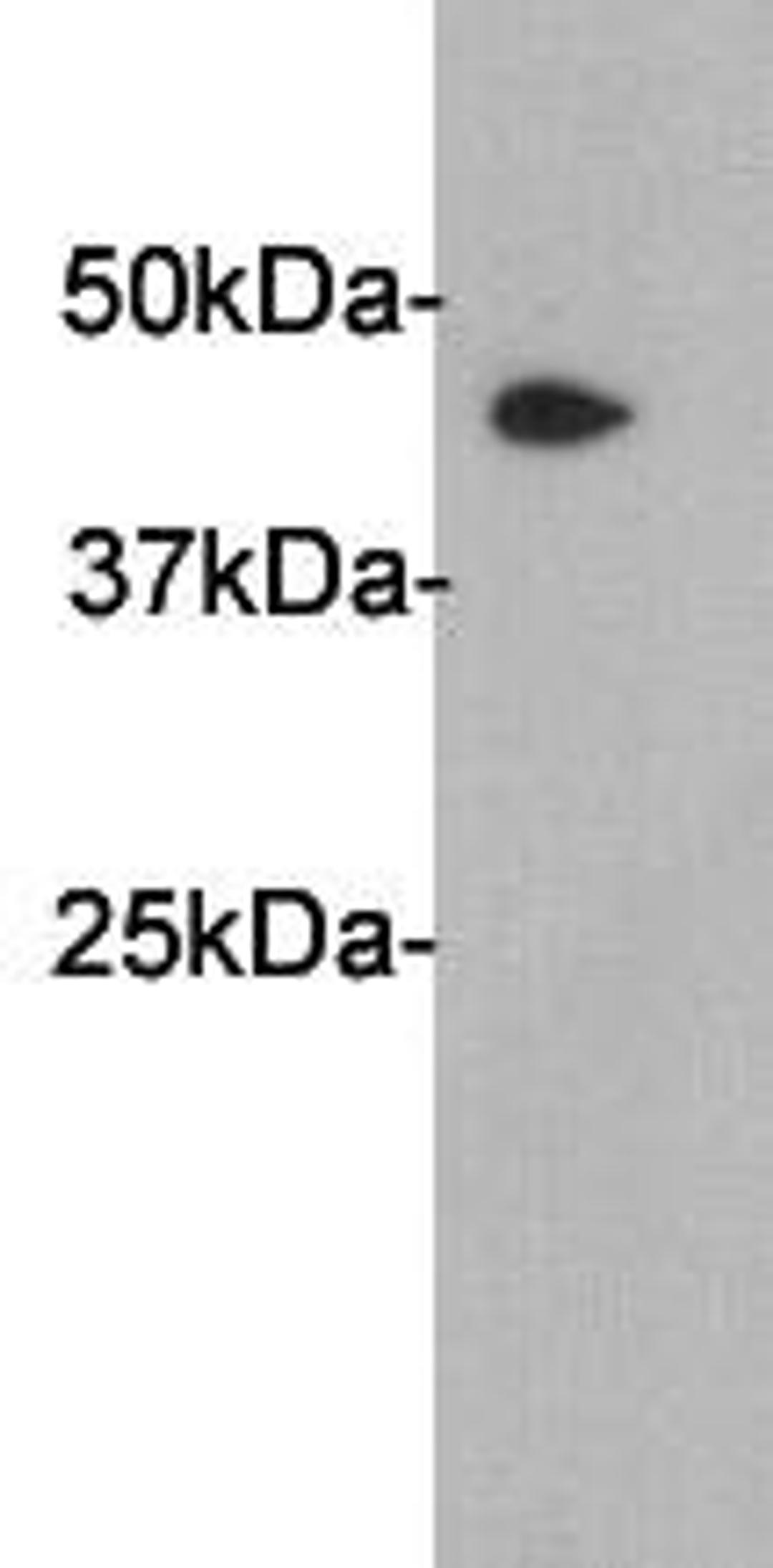 Western Blot analysis of cell lysate using PAI3 antibody