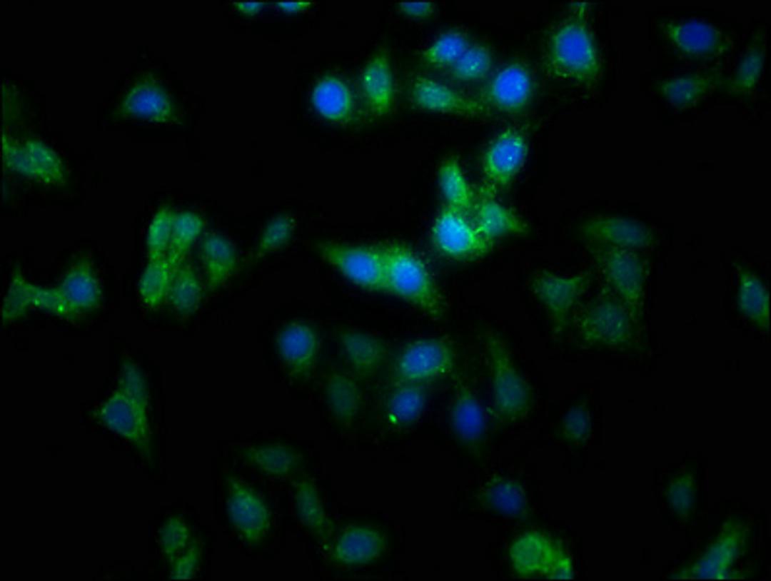 Immunofluorescence staining of HepG2 cells with CSB-PA014655LA01HU at 1:100, counter-stained with DAPI. The cells were fixed in 4% formaldehyde, permeabilized using 0.2% Triton X-100 and blocked in 10% normal Goat Serum. The cells were then incubated with the antibody overnight at 4&deg;C. The secondary antibody was Alexa Fluor 488-congugated AffiniPure Goat Anti-Rabbit IgG(H+L).