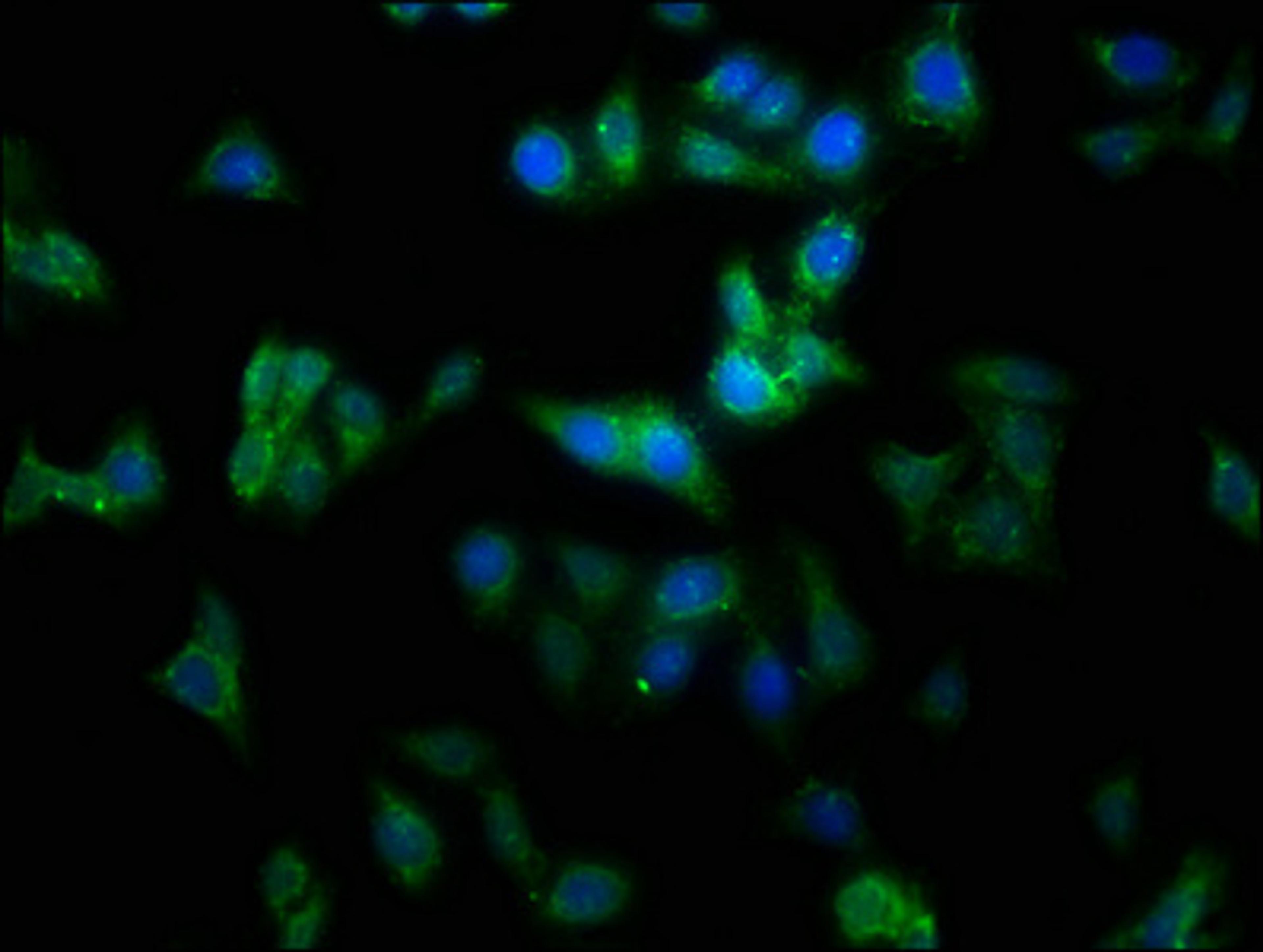 Immunofluorescence staining of HepG2 cells with CSB-PA014655LA01HU at 1:100, counter-stained with DAPI. The cells were fixed in 4% formaldehyde, permeabilized using 0.2% Triton X-100 and blocked in 10% normal Goat Serum. The cells were then incubated with the antibody overnight at 4&deg;C. The secondary antibody was Alexa Fluor 488-congugated AffiniPure Goat Anti-Rabbit IgG(H+L).
