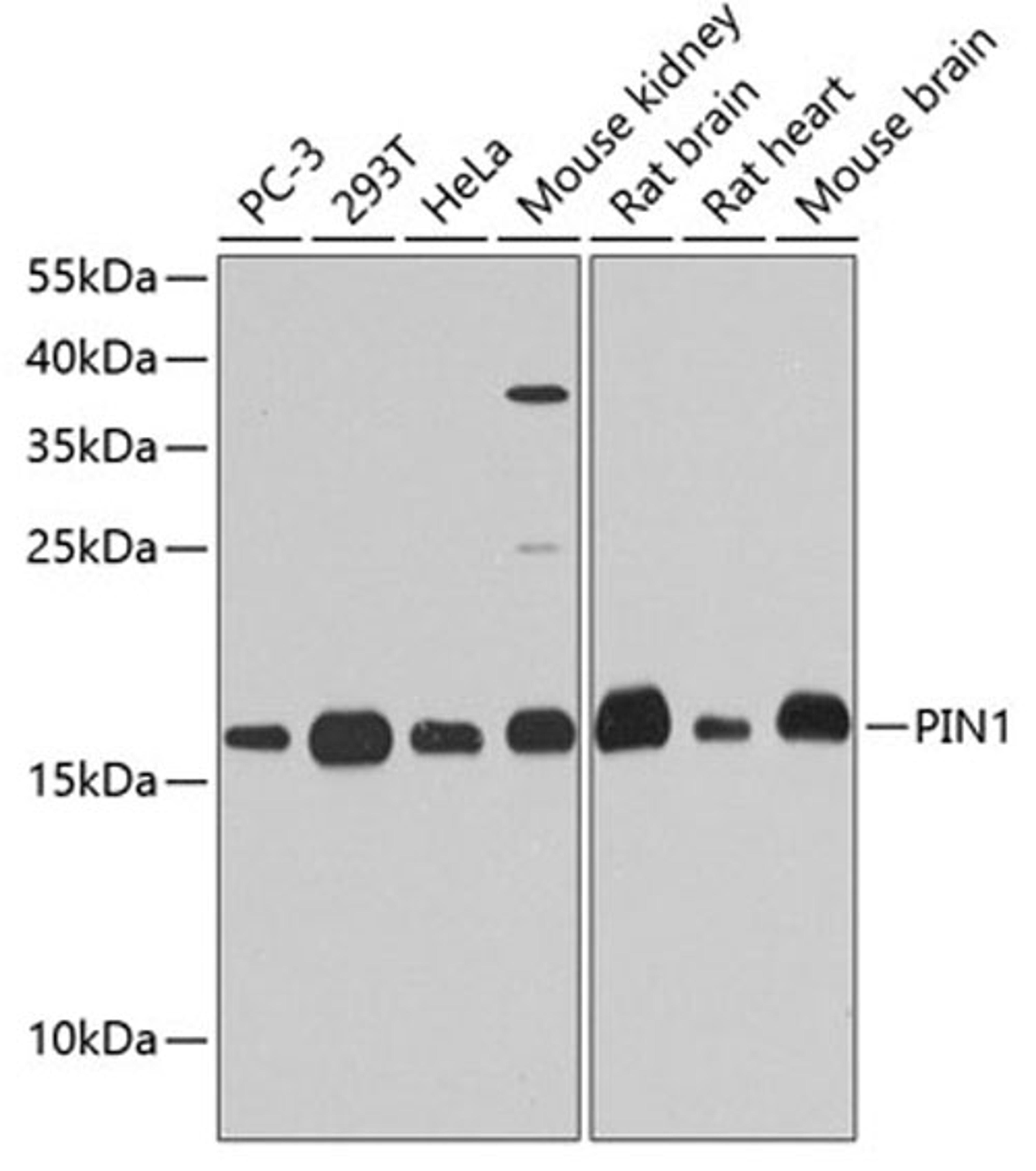 Western blot - PIN1 antibody (A2106)