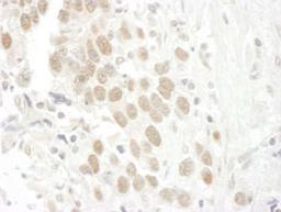 Detection of human BCCIP by immunohistochemistry.