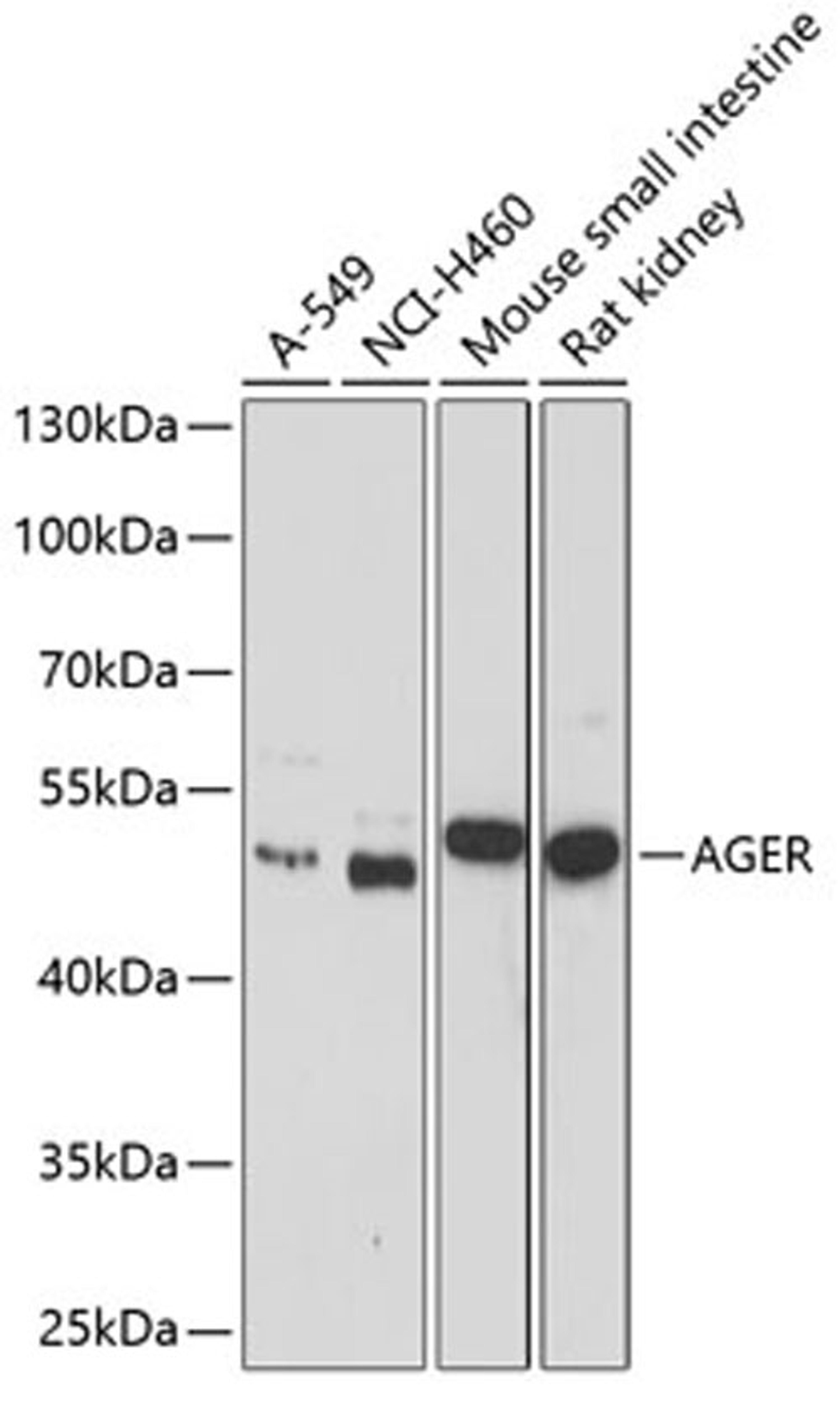 Western blot - AGER antibody (A1395)