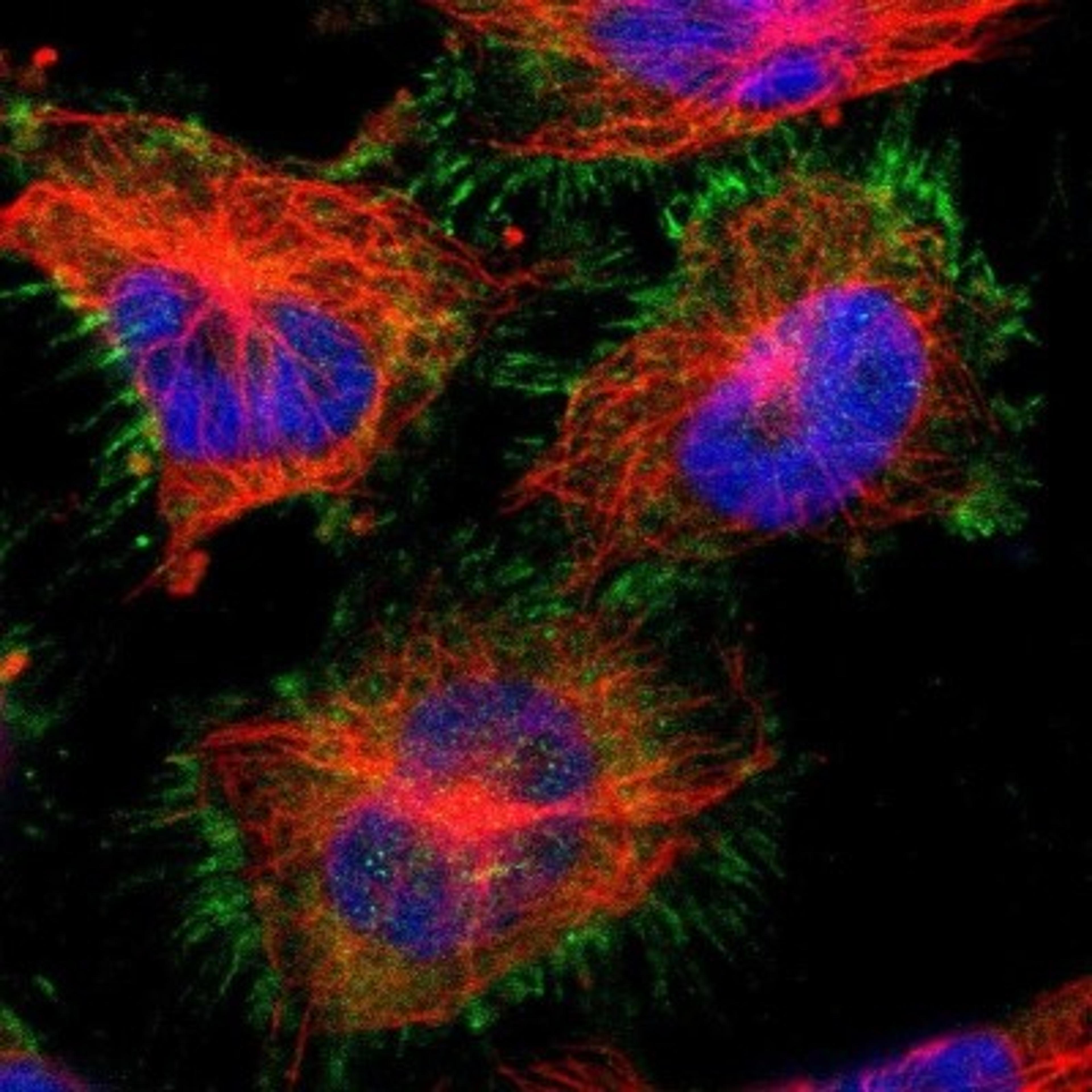 Immunocytochemistry/Immunofluorescence: SorCS1 Antibody [NBP1-86096] - Immunofluorescent staining of human cell line U-251MG shows positivity in plasma membrane & cytoplasm.