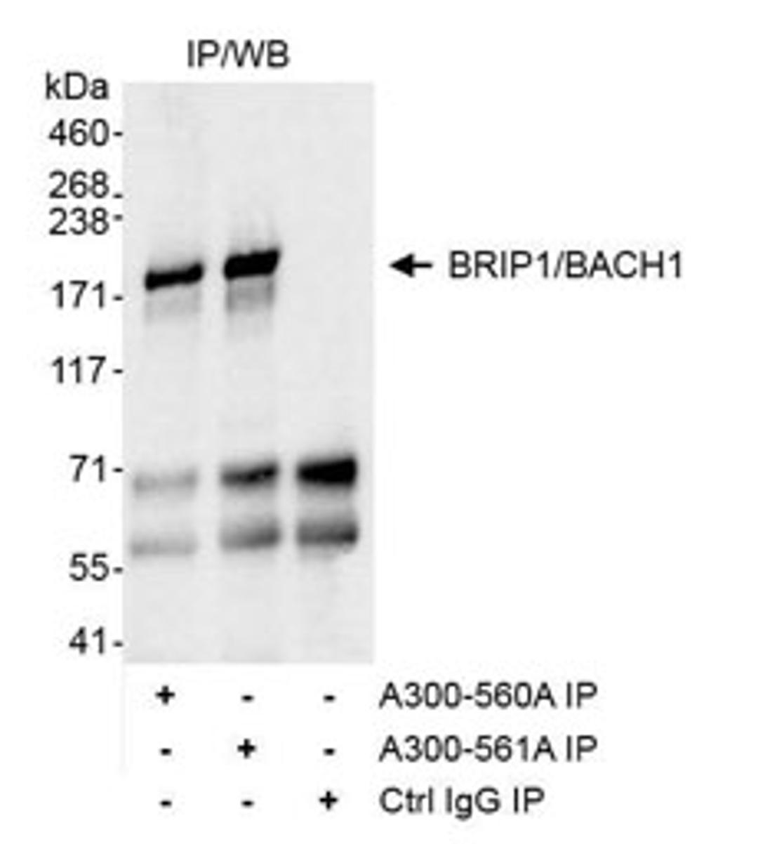 Detection of human BRIP1/BACH1 by WB of immunoprecipitates.