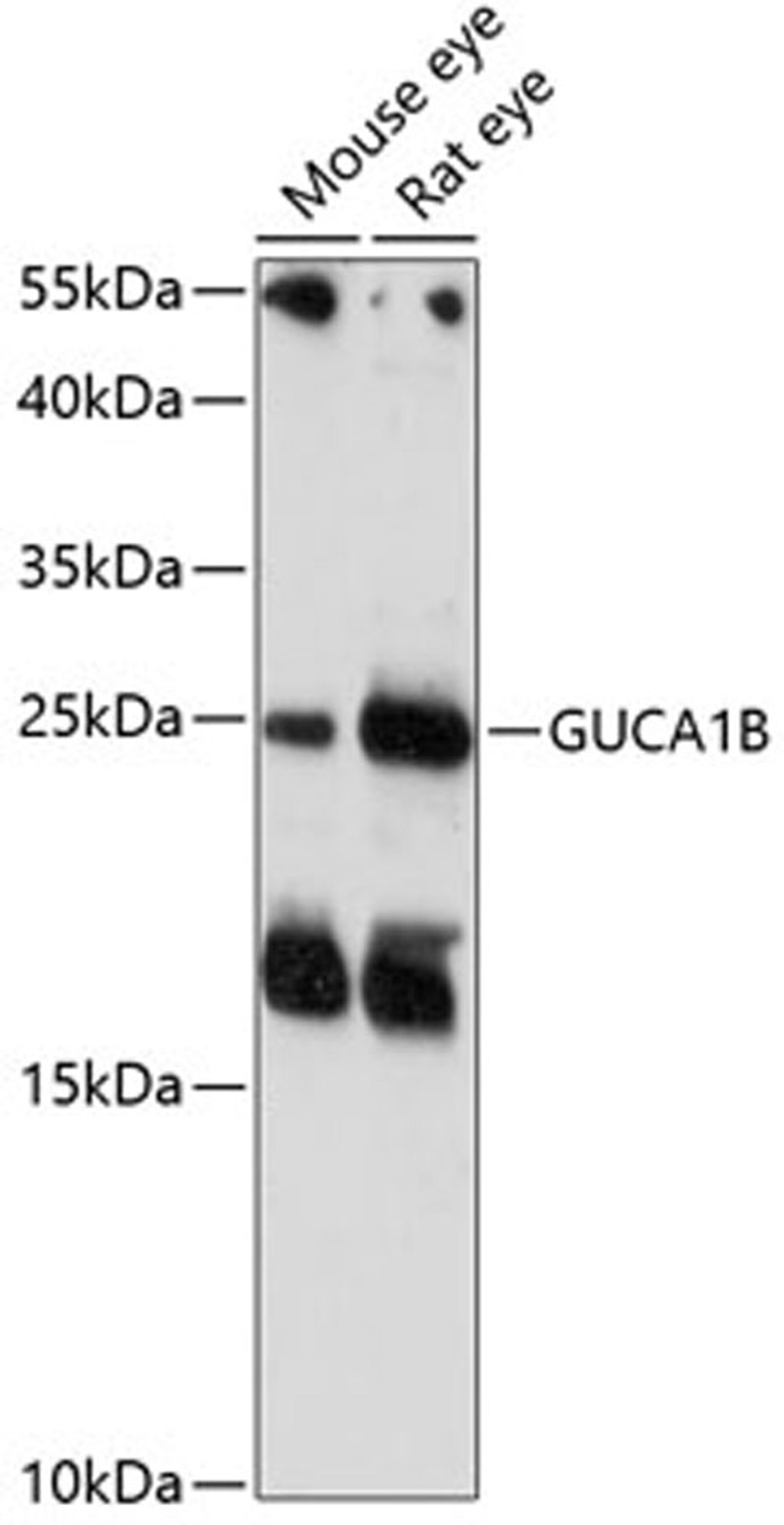 Western blot - GUCA1B antibody (A14739)