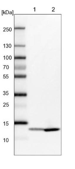 Western Blot: FABP1/L-FABP Antibody [NBP1-87695] - Lane 1: Mouse liver tissue lysate<br/>Lane 2: Rat liver tissue lysate