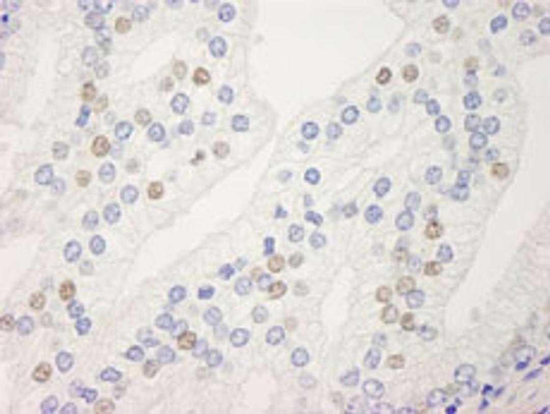 Detection of human UACA by immunohistochemistry.