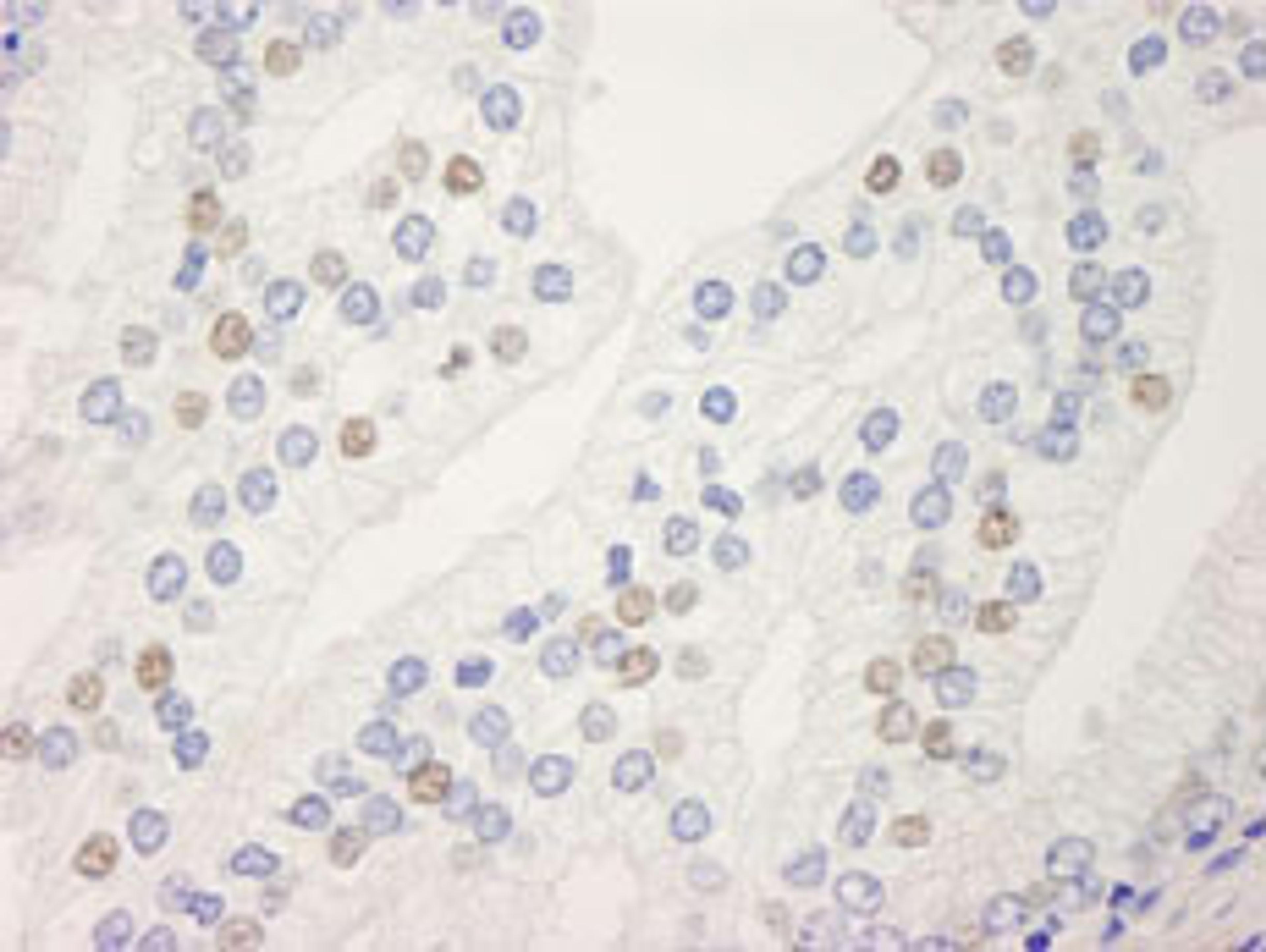 Detection of human UACA by immunohistochemistry.