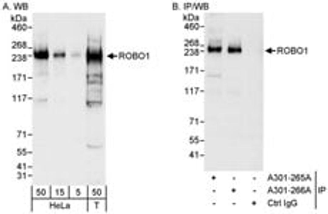 Detection of human ROBO1 by western blot and immunoprecipitation.