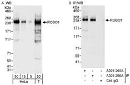 Detection of human ROBO1 by western blot and immunoprecipitation.