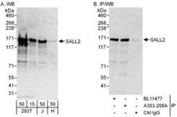 Detection of human SALL2 by western blot and immunoprecipitation.