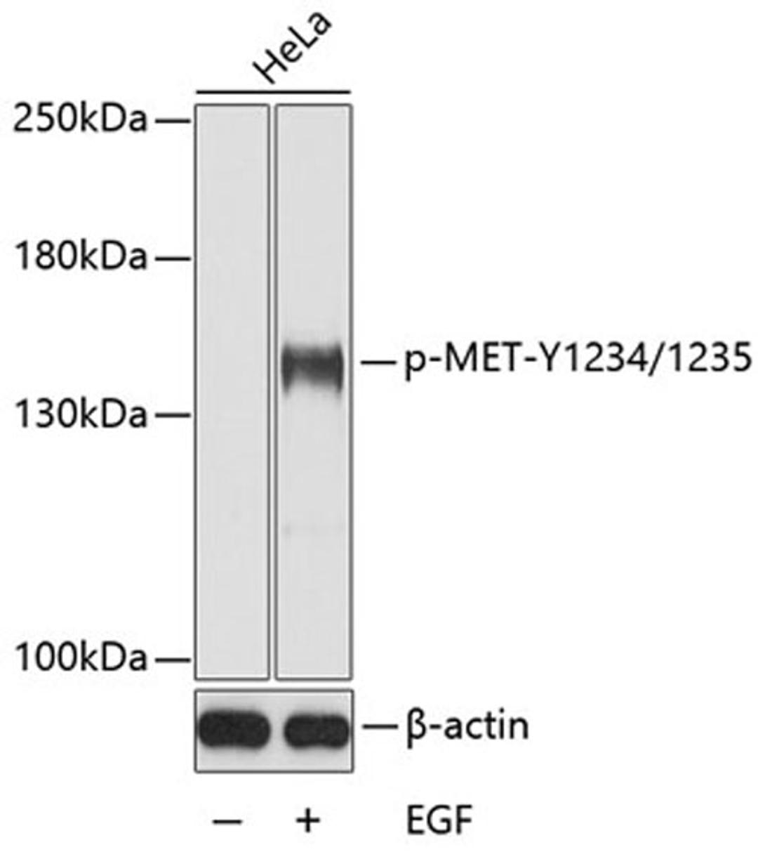 Western blot - Phospho-MET-Y1234/1235 antibody (AP0533)