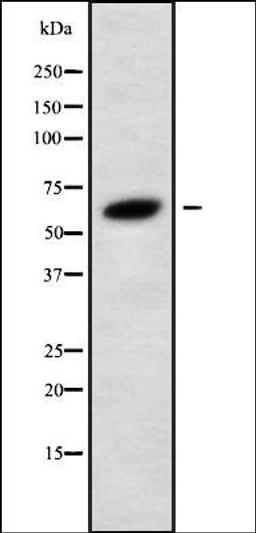 Western blot analysis of 293 whole cell lysates using GLP2R antibody