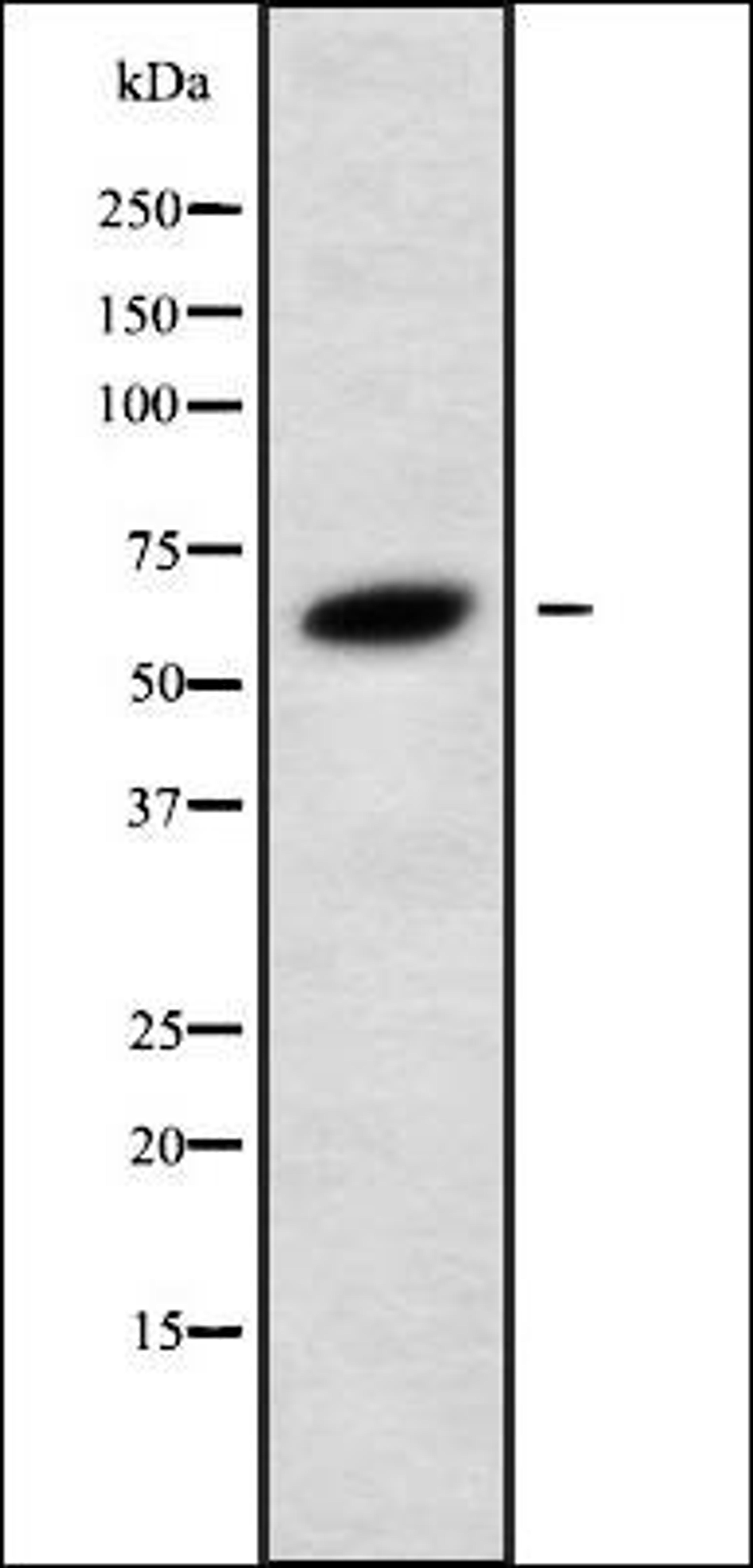 Western blot analysis of 293 whole cell lysates using GLP2R antibody