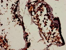 Immunohistochemistry analysis of human testis tissue using CSB-PA002615LA01HU at dilution of 1:100