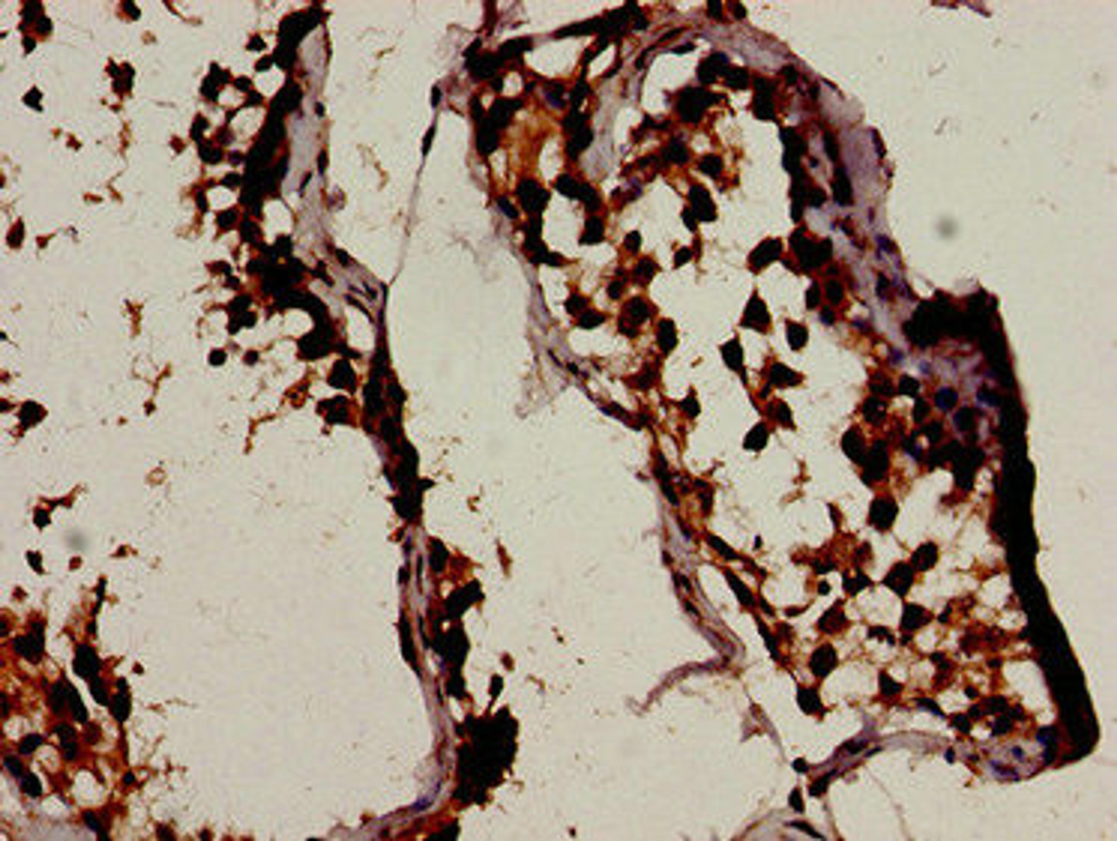 Immunohistochemistry analysis of human testis tissue using CSB-PA002615LA01HU at dilution of 1:100