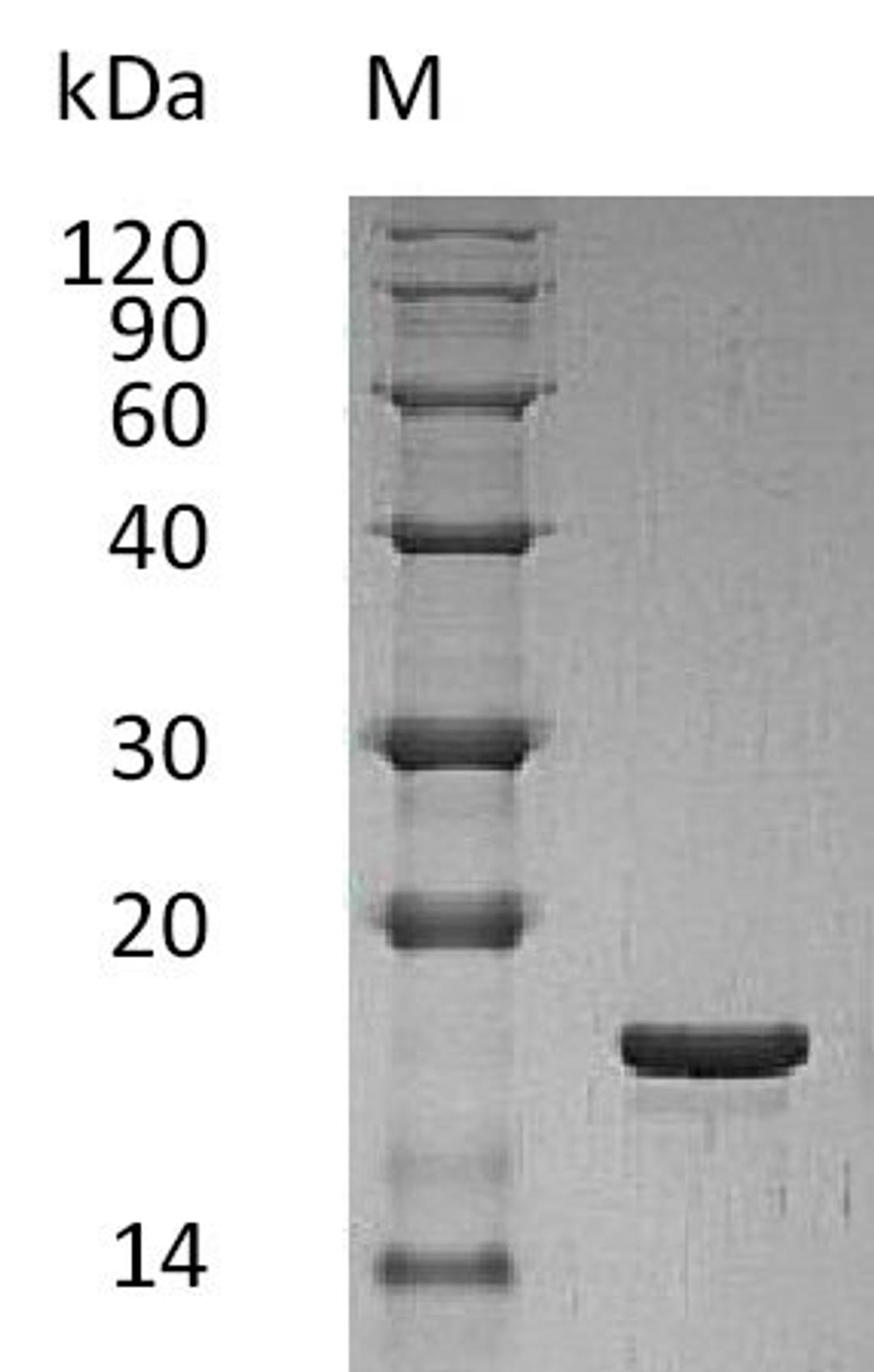 (Tris-Glycine gel) Discontinuous SDS-PAGE (reduced) with 5% enrichment gel and 15% separation gel.