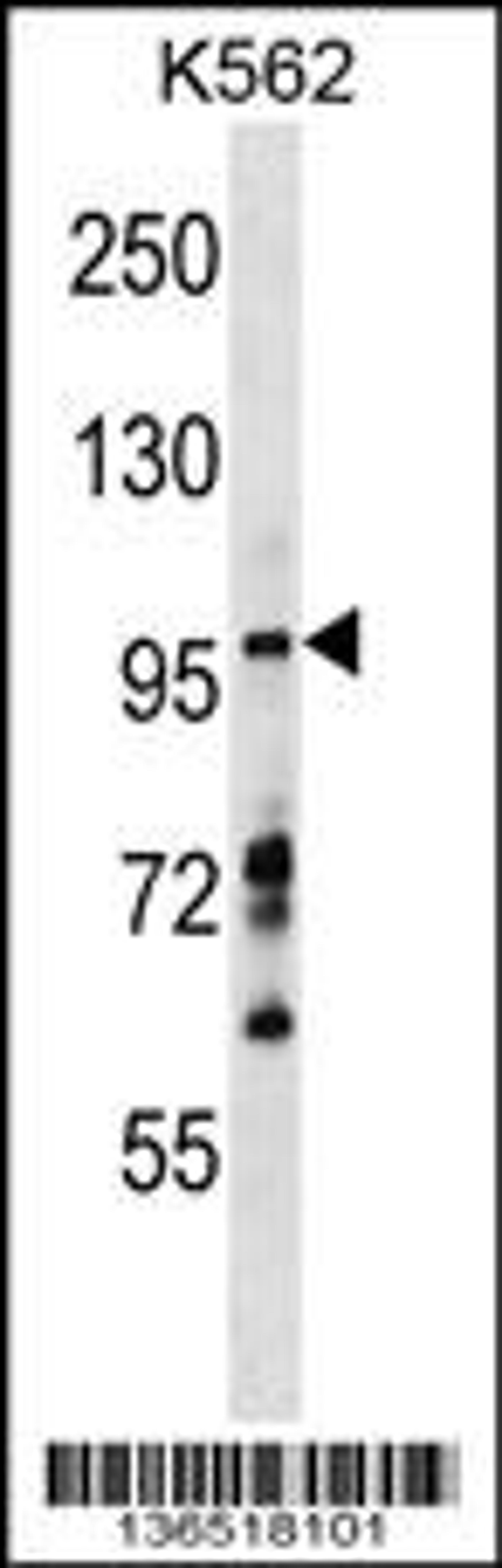 Western blot analysis in K562 cell line lysates (35ug/lane).