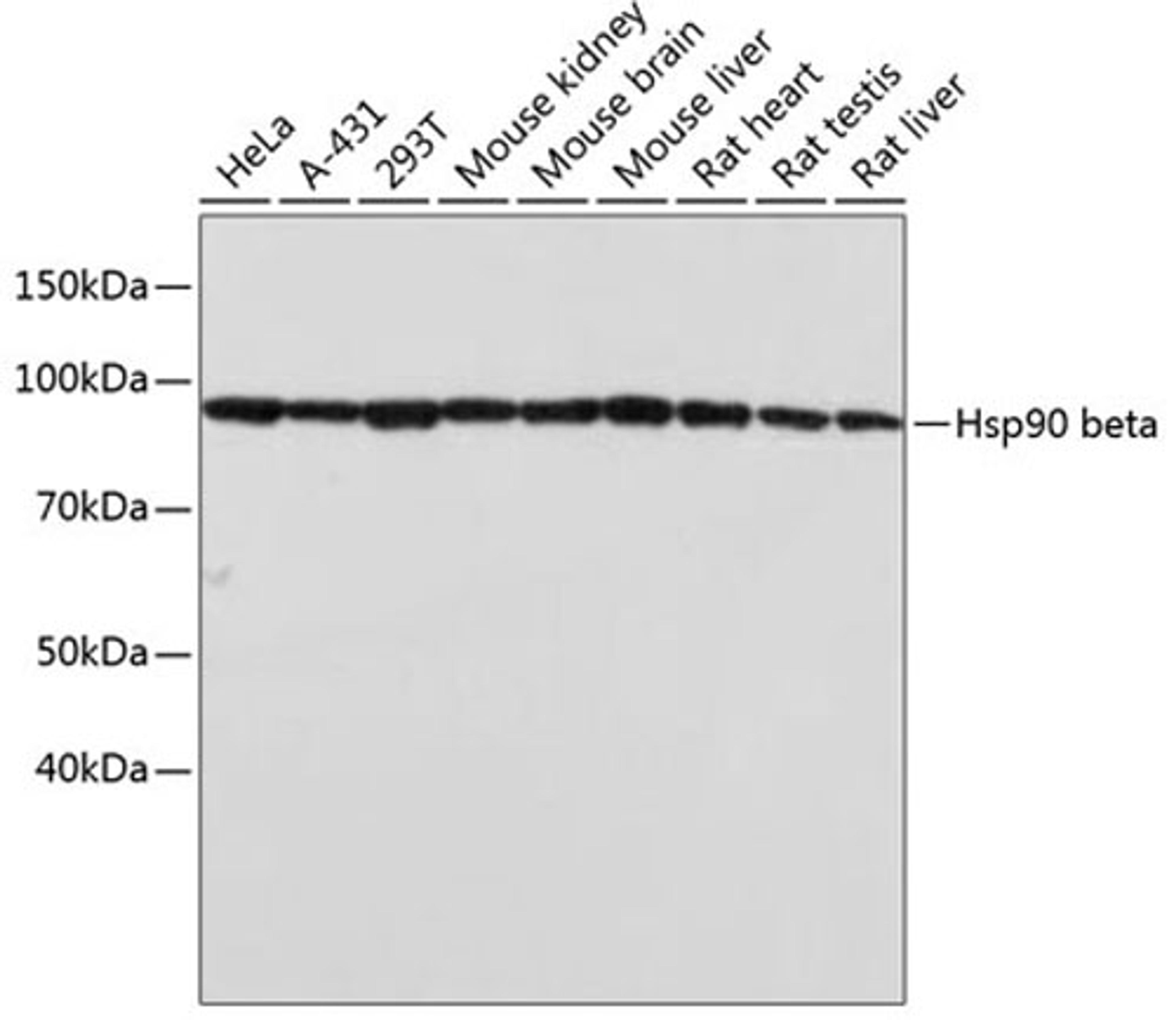 Western blot - Hsp90 beta antibody (A19574)