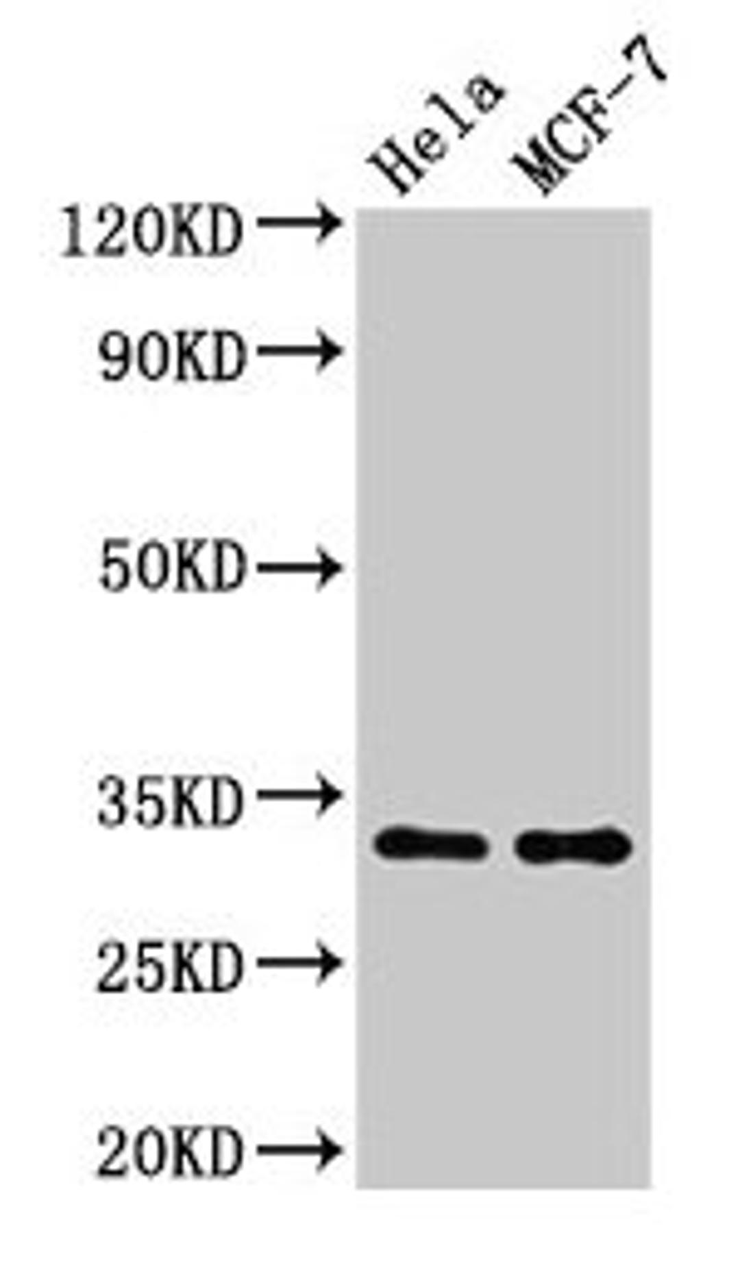 Western Blot. Positive WB detected in: Hela whole cell lysate, MCF-7 whole cell lysate. All lanes: HIST1H1B antibody at 1.5µg/ml. Secondary. Goat polyclonal to rabbit IgG at 1/50000 dilution. Predicted band size: 23 kDa. Observed band size: 32 kDa
