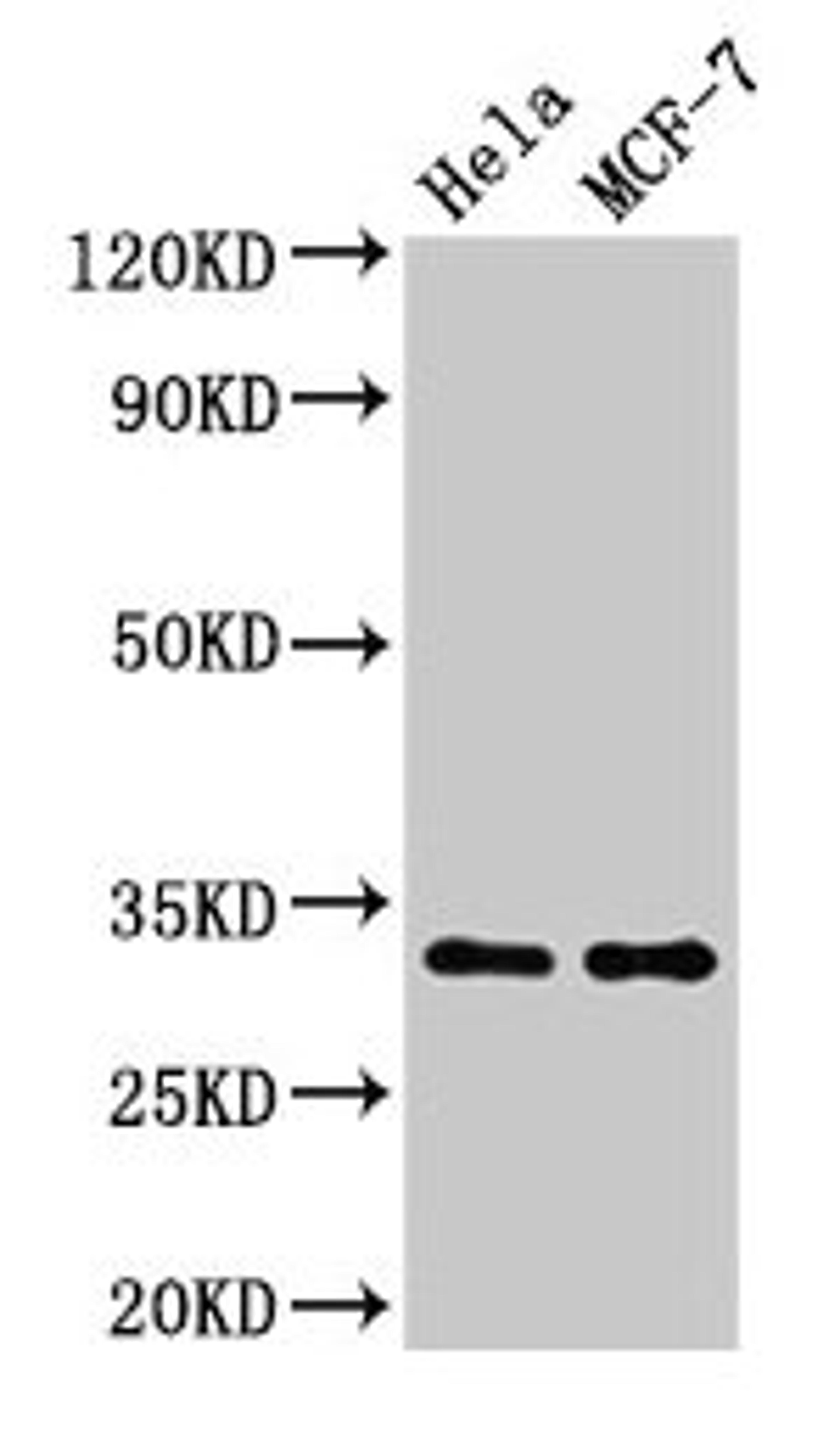 Western Blot. Positive WB detected in: Hela whole cell lysate, MCF-7 whole cell lysate. All lanes: HIST1H1B antibody at 1.5µg/ml. Secondary. Goat polyclonal to rabbit IgG at 1/50000 dilution. Predicted band size: 23 kDa. Observed band size: 32 kDa