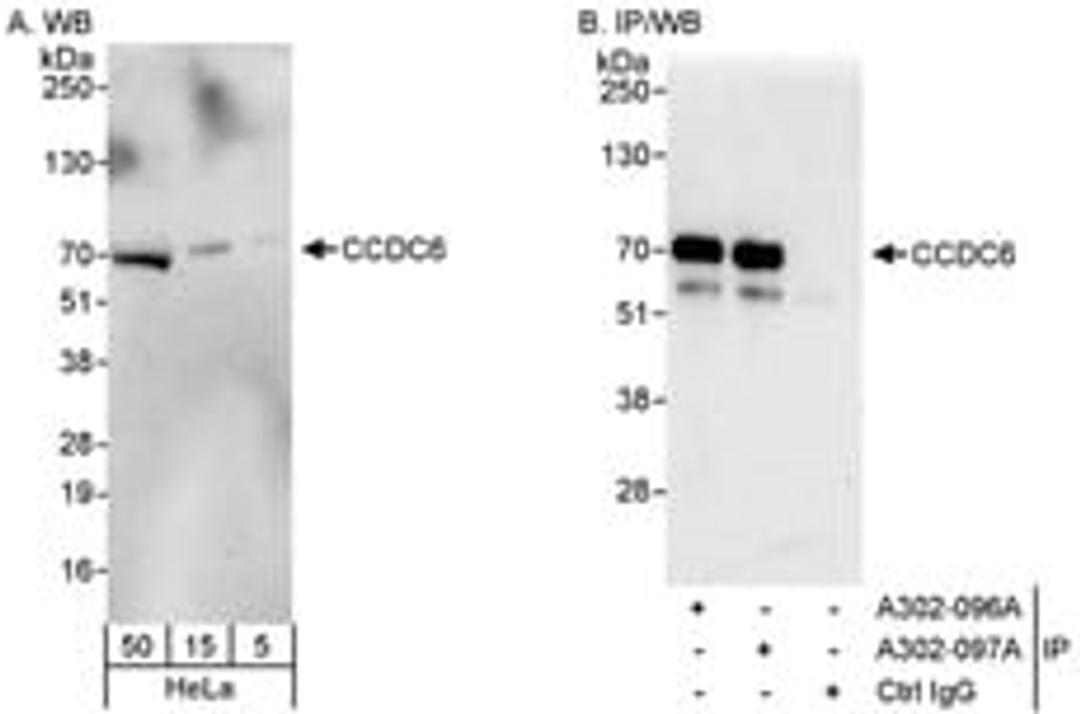 Detection of human CCDC6 by western blot and immunoprecipitation.