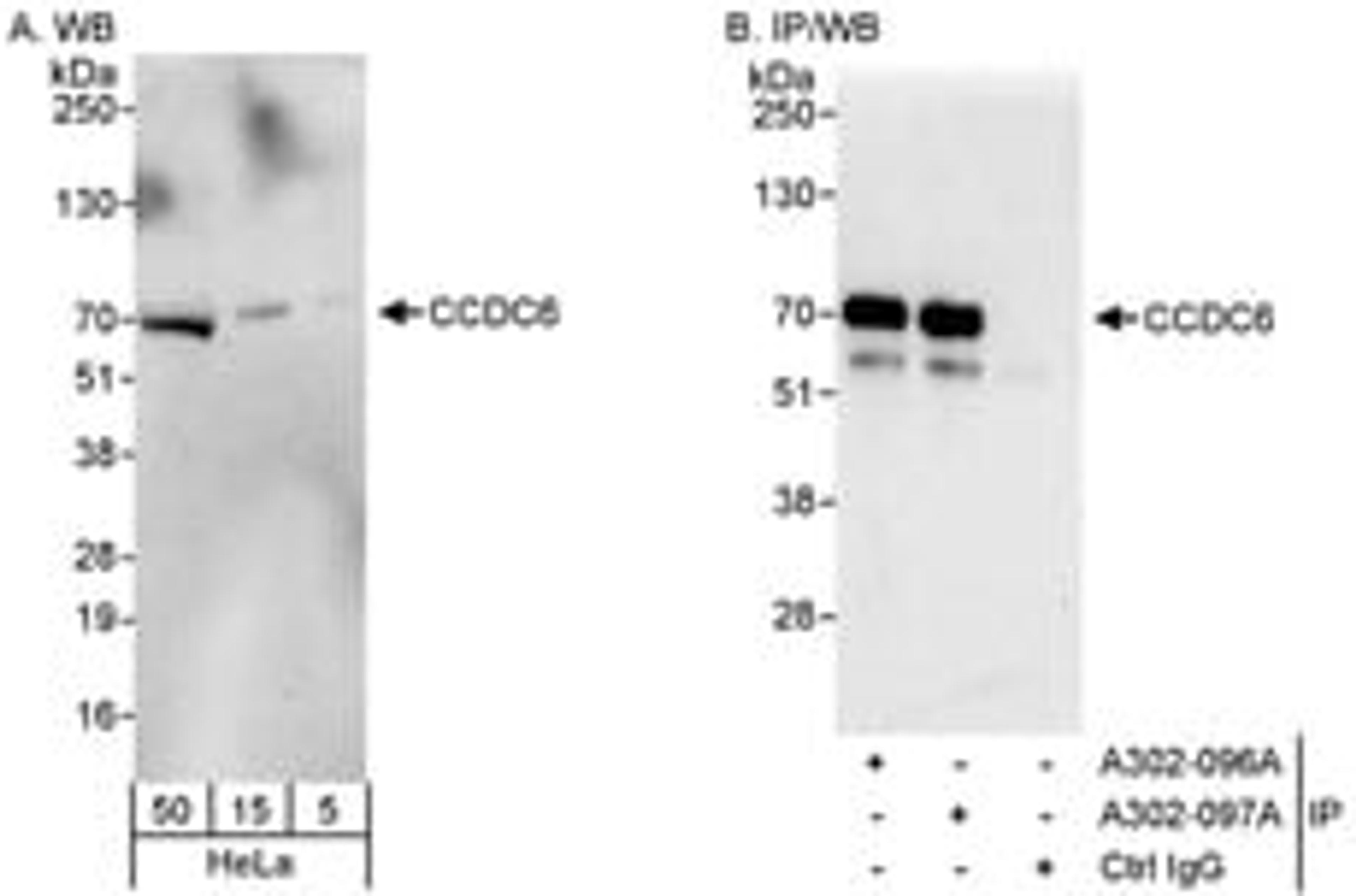 Detection of human CCDC6 by western blot and immunoprecipitation.