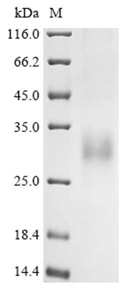 (Tris-Glycine gel) Discontinuous SDS-PAGE (reduced) with 5% enrichment gel and 15% separation gel.