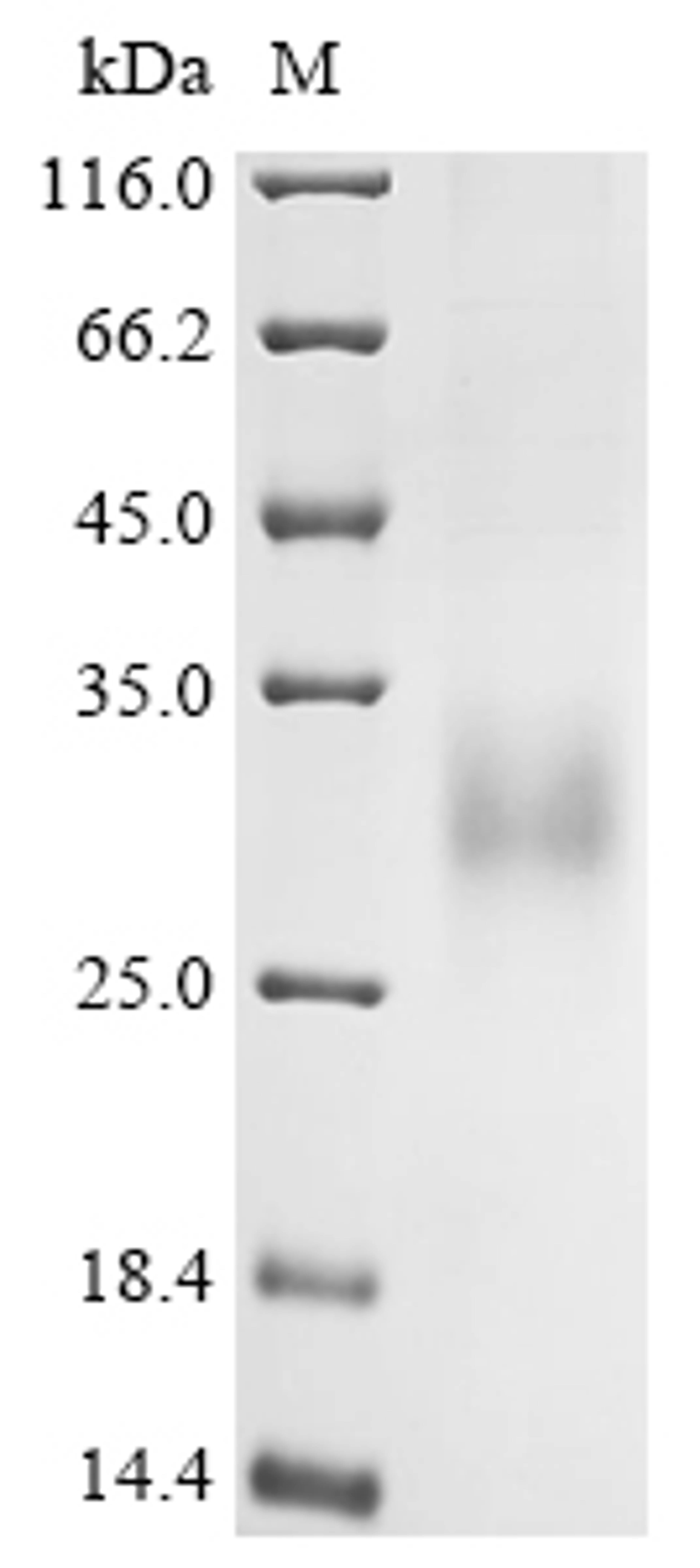 (Tris-Glycine gel) Discontinuous SDS-PAGE (reduced) with 5% enrichment gel and 15% separation gel.