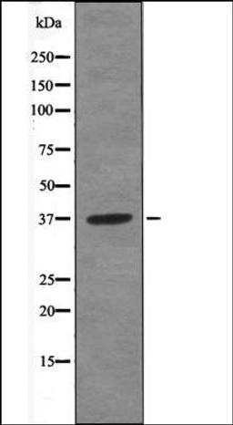 Western blot analysis of Jurkat whole cell lysates using ANXA1 -Phospho-Tyr21- antibody