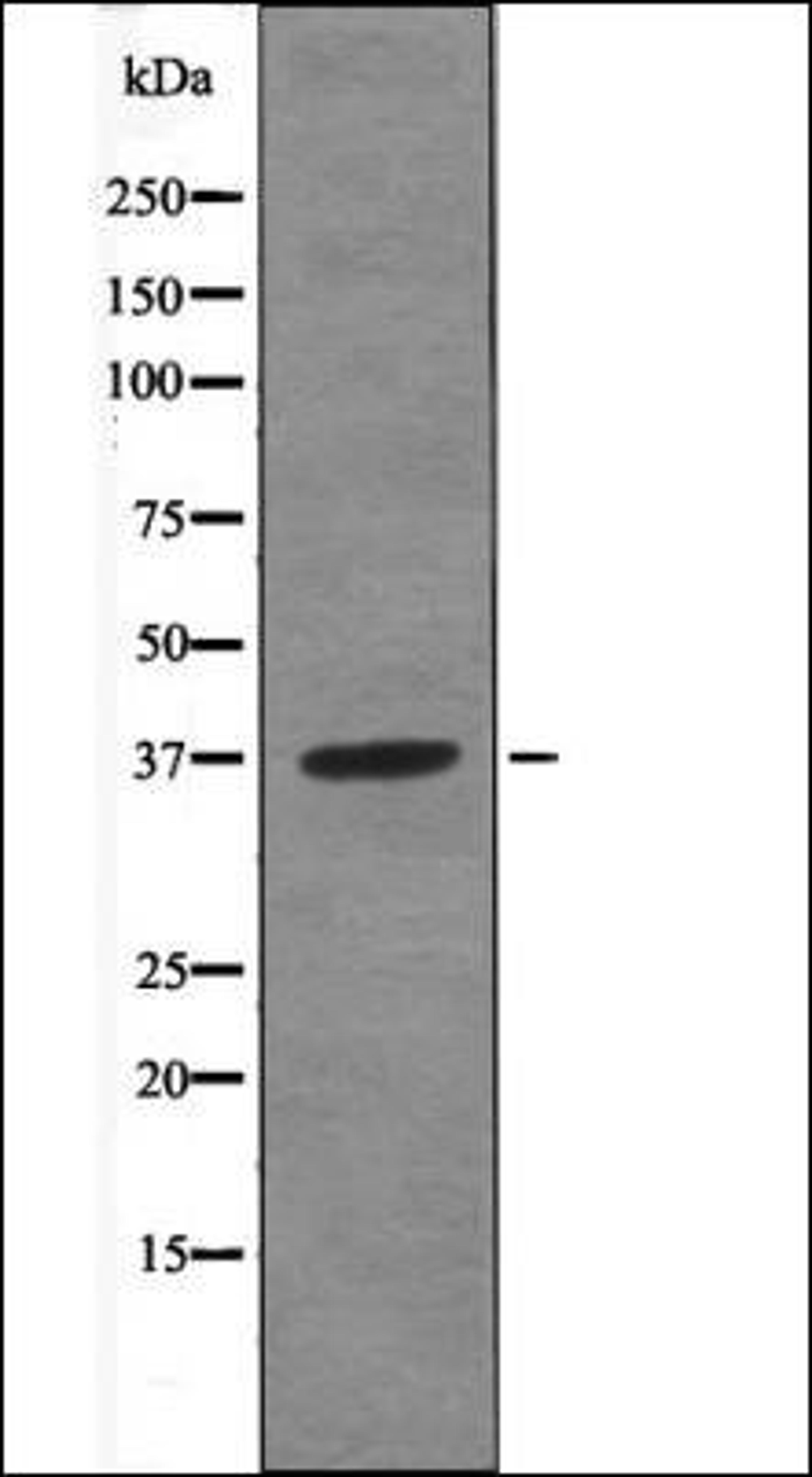 Western blot analysis of Jurkat whole cell lysates using ANXA1 -Phospho-Tyr21- antibody