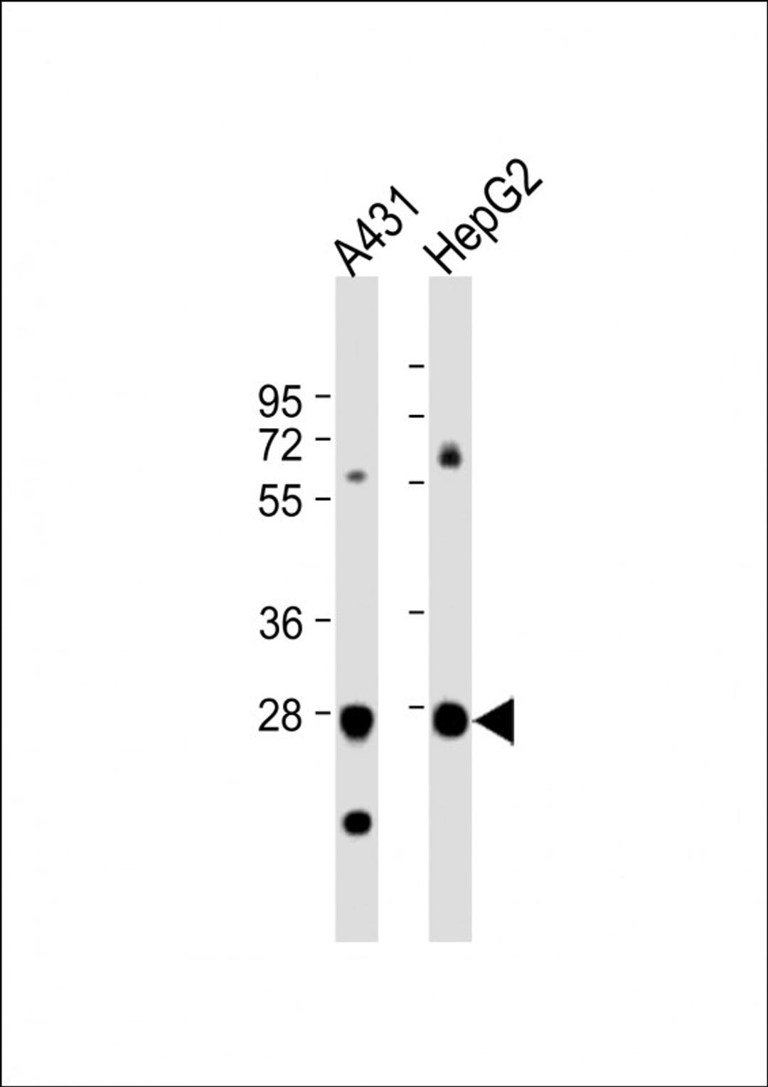 Western Blot at 1:1000 dilution Lane 1: A431 whole cell lysate Lane 2: HepG2 whole cell lysate Lysates/proteins at 20 ug per lane.