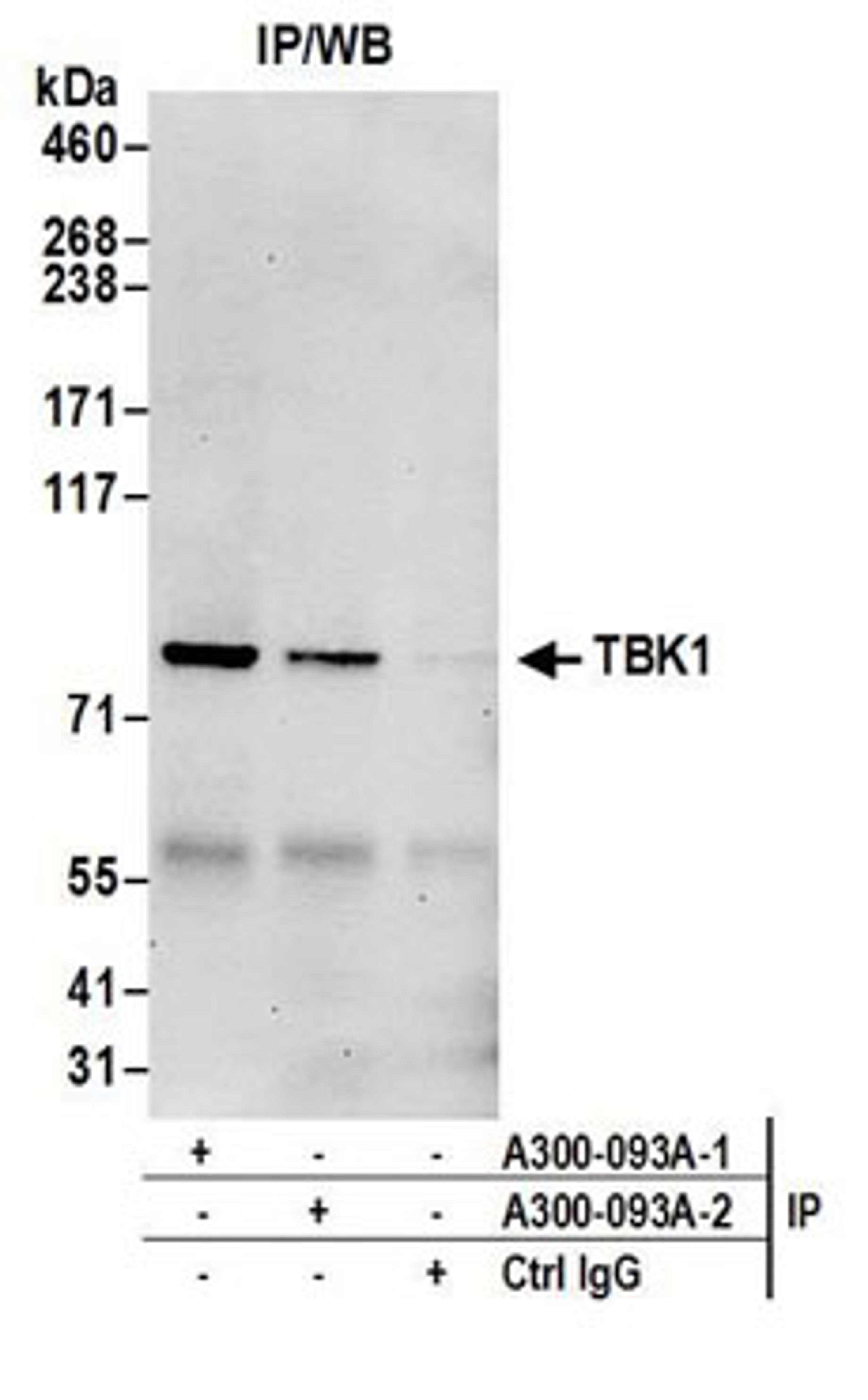 Detection of human TBK1 by western blot of immunoprecipitates.