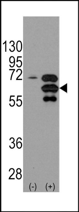 Western blot analysis of INA using rabbit polyclonal INA Antibody using 293 cell lysates (2 ug/lane) either nontransfected (Lane 1) or transiently transfected with the INA gene (Lane 2).