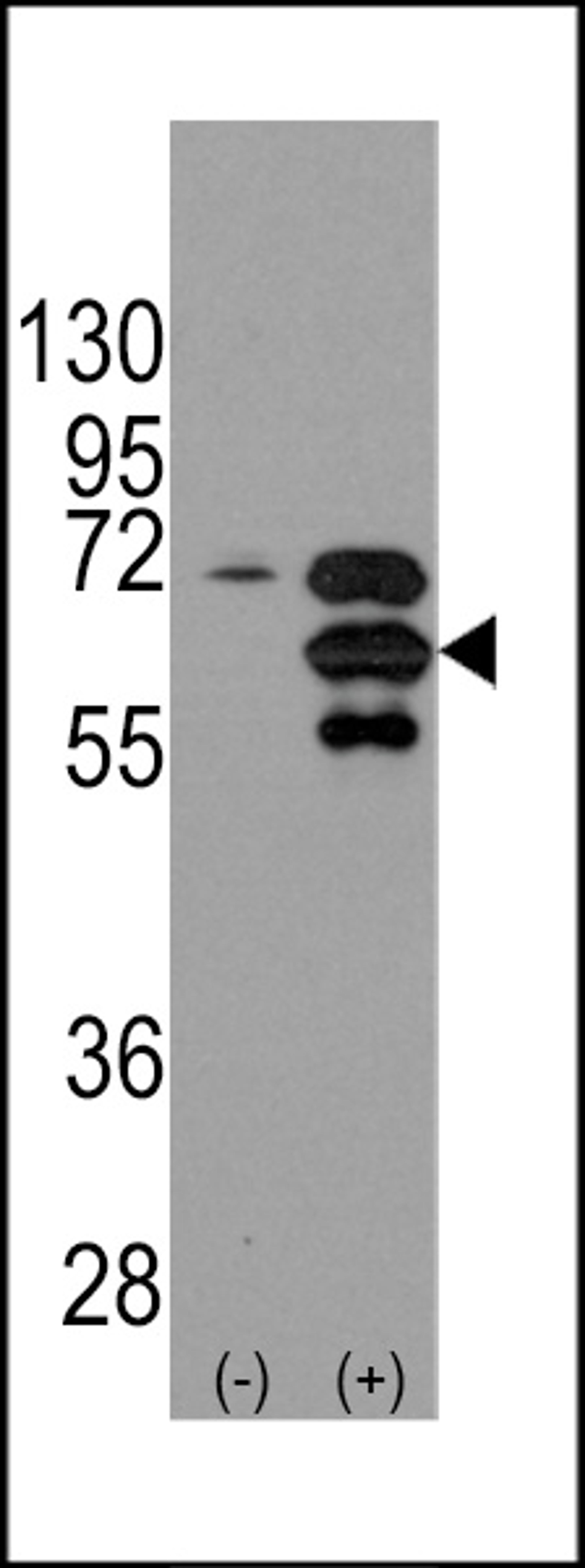 Western blot analysis of INA using rabbit polyclonal INA Antibody using 293 cell lysates (2 ug/lane) either nontransfected (Lane 1) or transiently transfected with the INA gene (Lane 2).