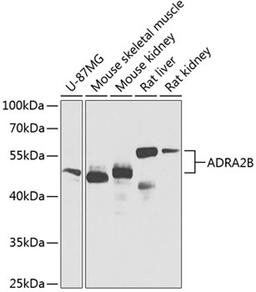 Western blot - ADRA2B Antibody (A8535)