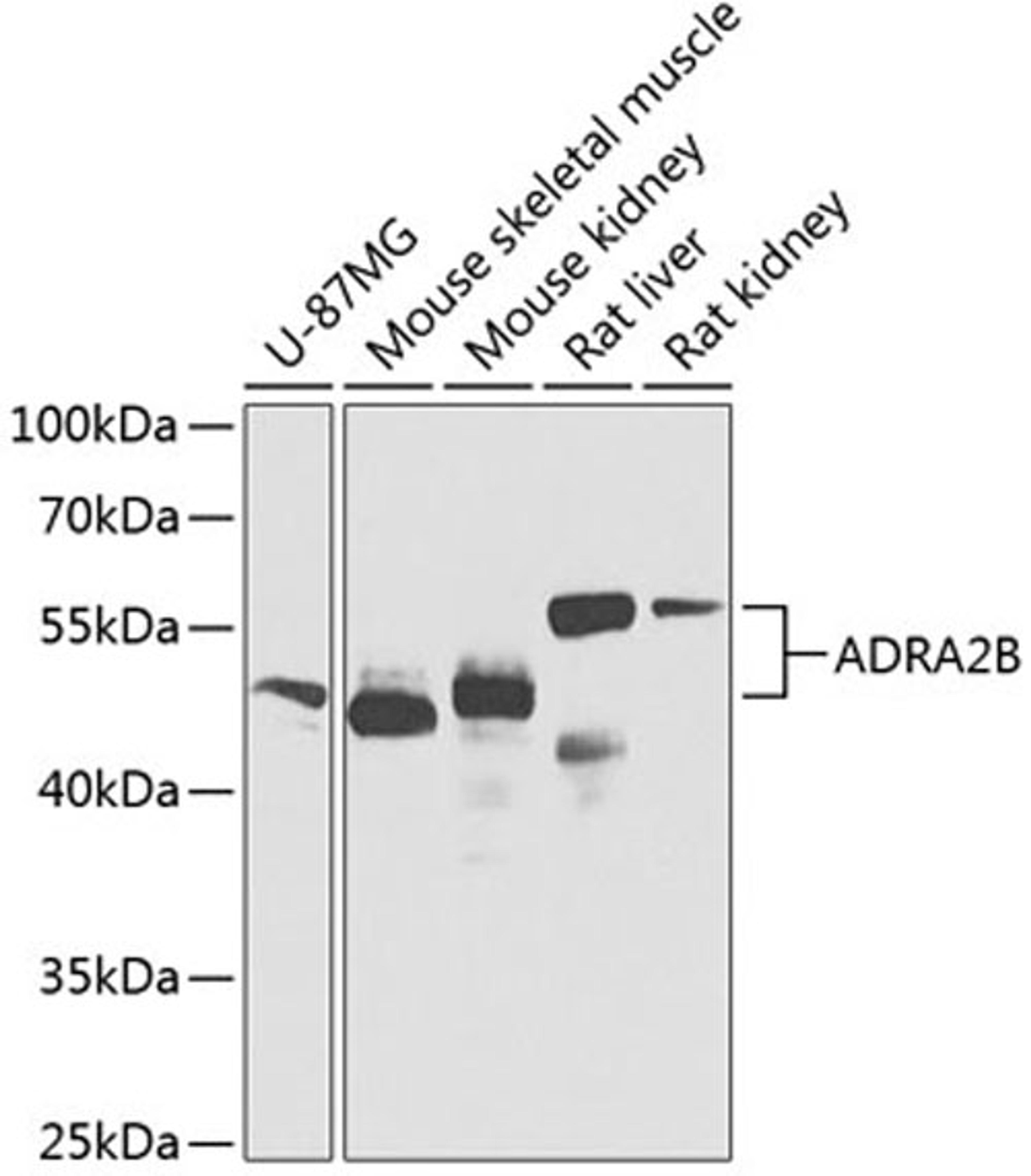 Western blot - ADRA2B Antibody (A8535)