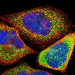 Immunocytochemistry/Immunofluorescence: C20orf26 Antibody [NBP1-90583] - Staining of human cell line A-431 shows positivity in cytoplasm.