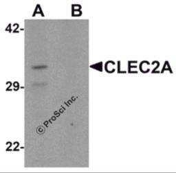 Western blot analysis of CLEC2A in K562 cell lysate with CLEC2A antibody at 1 &#956;g/ml in (A) the absence and (B) the presence of blocking peptide.