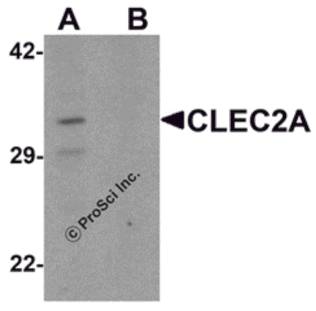 Western blot analysis of CLEC2A in K562 cell lysate with CLEC2A antibody at 1 μg/ml in (A) the absence and (B) the presence of blocking peptide.