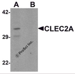 Western blot analysis of CLEC2A in K562 cell lysate with CLEC2A antibody at 1 μg/ml in (A) the absence and (B) the presence of blocking peptide.